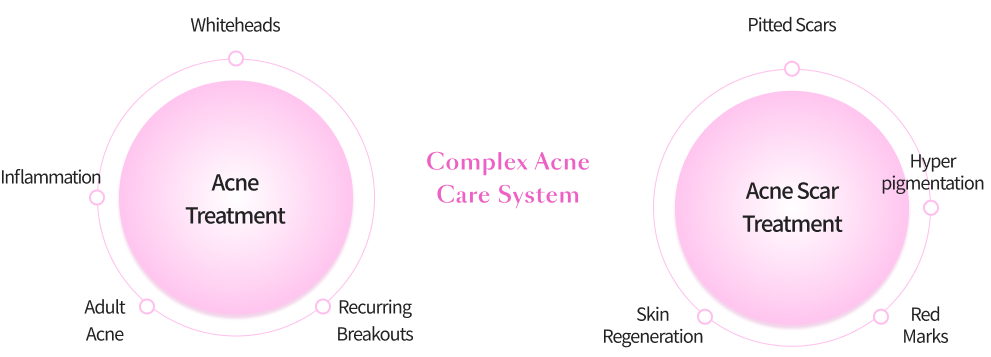 Acne scar treatment infographic