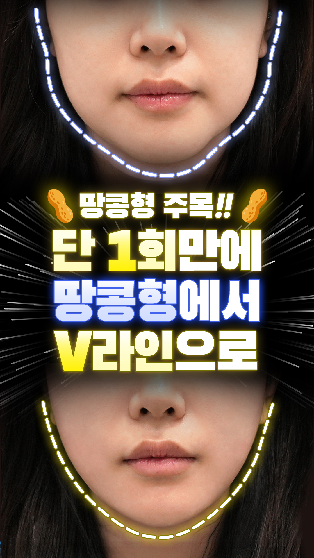 올타이트 숏폼 1