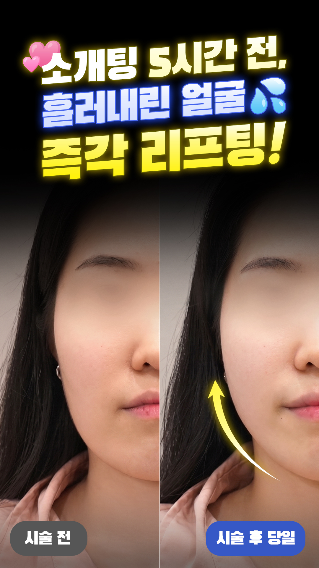 올타이트 숏폼 3