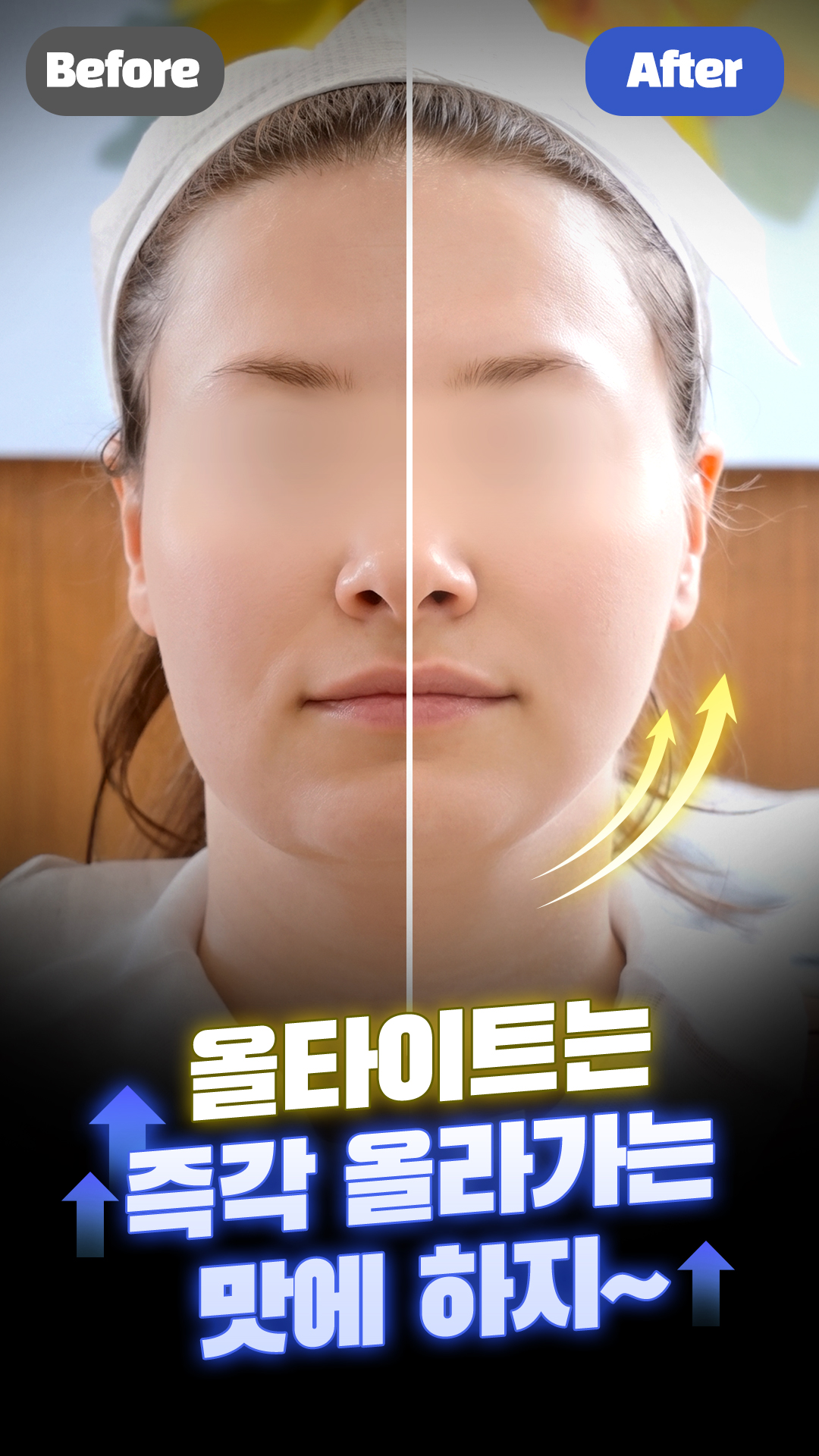 올타이트 숏폼 4