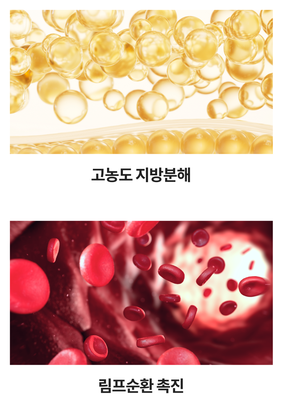 모바일 윤곽주사 지방분해·림프순환 시술 설명 이미지
