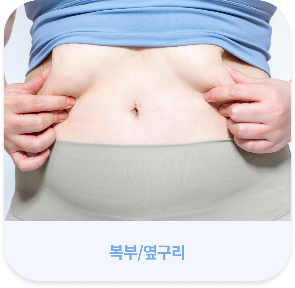 모바일 살빼주사 시술 가능 부위 - 복부/옆구리