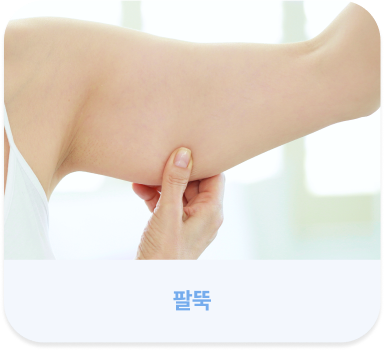 살빼주사 시술 가능 부위 - 팔뚝