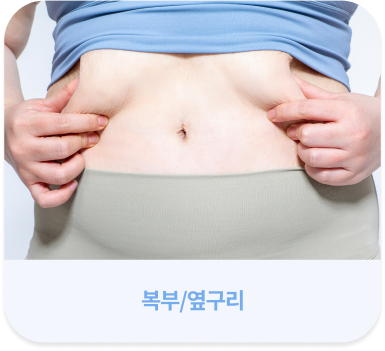 살빼주사 시술 가능 부위 - 복부/옆구리