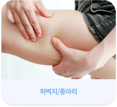 살빼주사 시술 가능 부위 - 허벅지/종아리