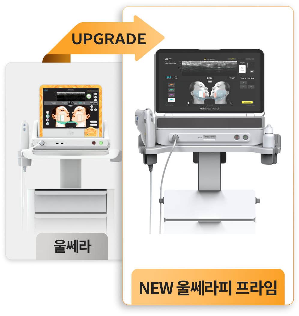 울쎄라피프라임 업그레이드 기기 모바일 이미지