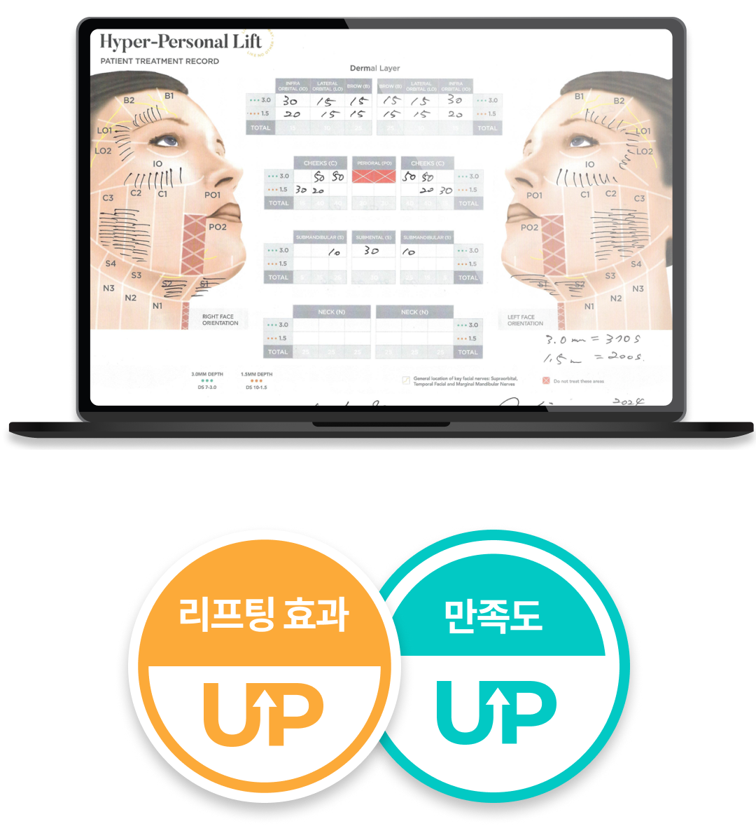 볼패임 걱정 없는 울쎄라피 프라임 모바일 설명 이미지