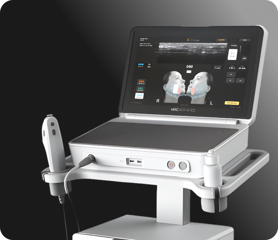 Mobile image of Ultherapy Prime device, structure of delivering energy to the SMAS layer using Ulthera DeepSEE technology