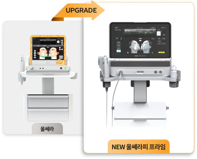 울쎄라피프라임 업그레이드 기기 이미지