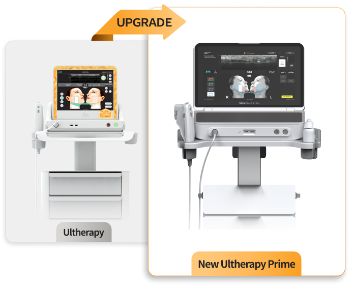 Ultherapy Prime Upgrade Device Image