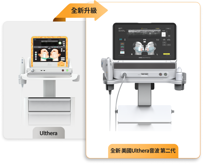 Ultherapy Prime 升級版儀器圖像