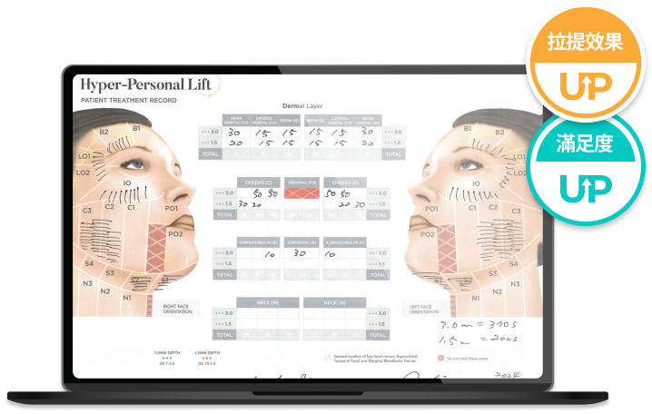 無需擔心臉頰凹陷的 Ultherapy Prime 療程方案說明圖像