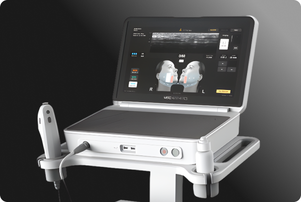 Ultherapy Prime device image, structure of delivering energy to the SMAS layer using Ulthera DeepSEE technology