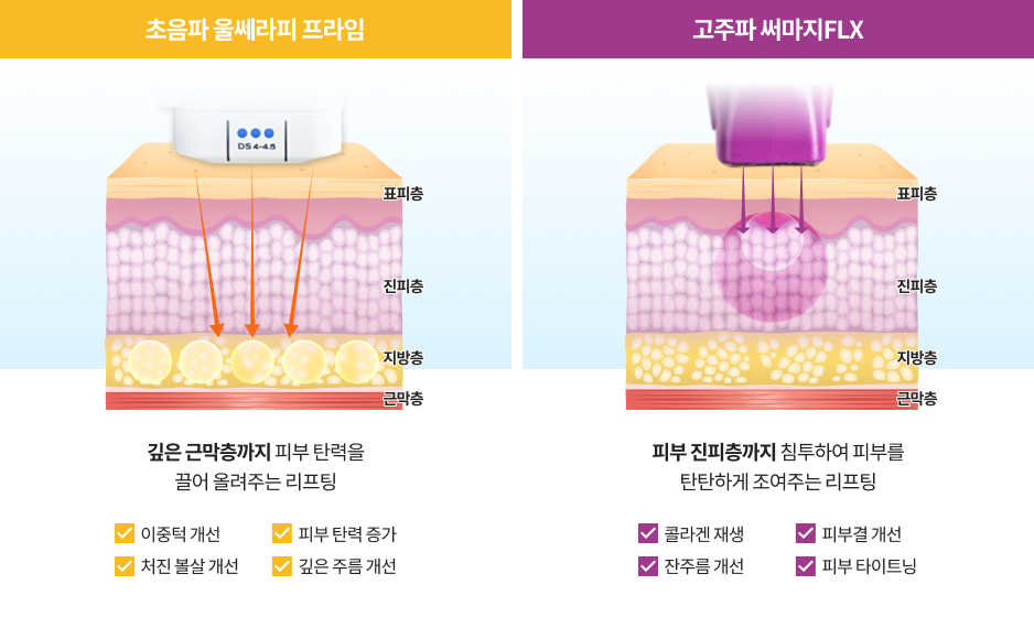 피부 깊은 층과 얕은 층을 동시에 케어하는 울써마지 이중 리프팅 설명 이미지