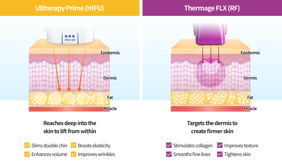 Illustration of Ulthermage dual lifting, caring for both deep and superficial skin layers simultaneously